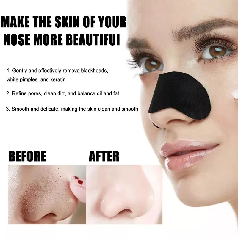 Lot de 10/50/100 autocollants pour éliminer les points noirs du visage - Autocollants efficaces pour nettoyer les pores et le nez, bâtonnets de soin doux et nettoyants en profondeur