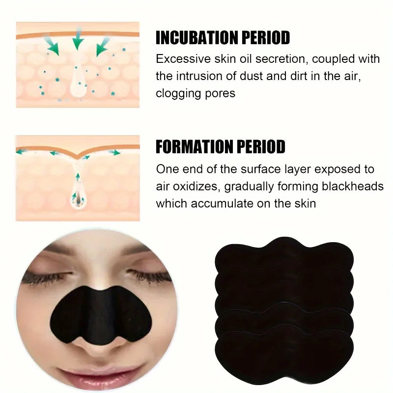 Lot de 10/50/100 autocollants pour éliminer les points noirs du visage - Autocollants efficaces pour nettoyer les pores et le nez, bâtonnets de soin doux et nettoyants en profondeur
