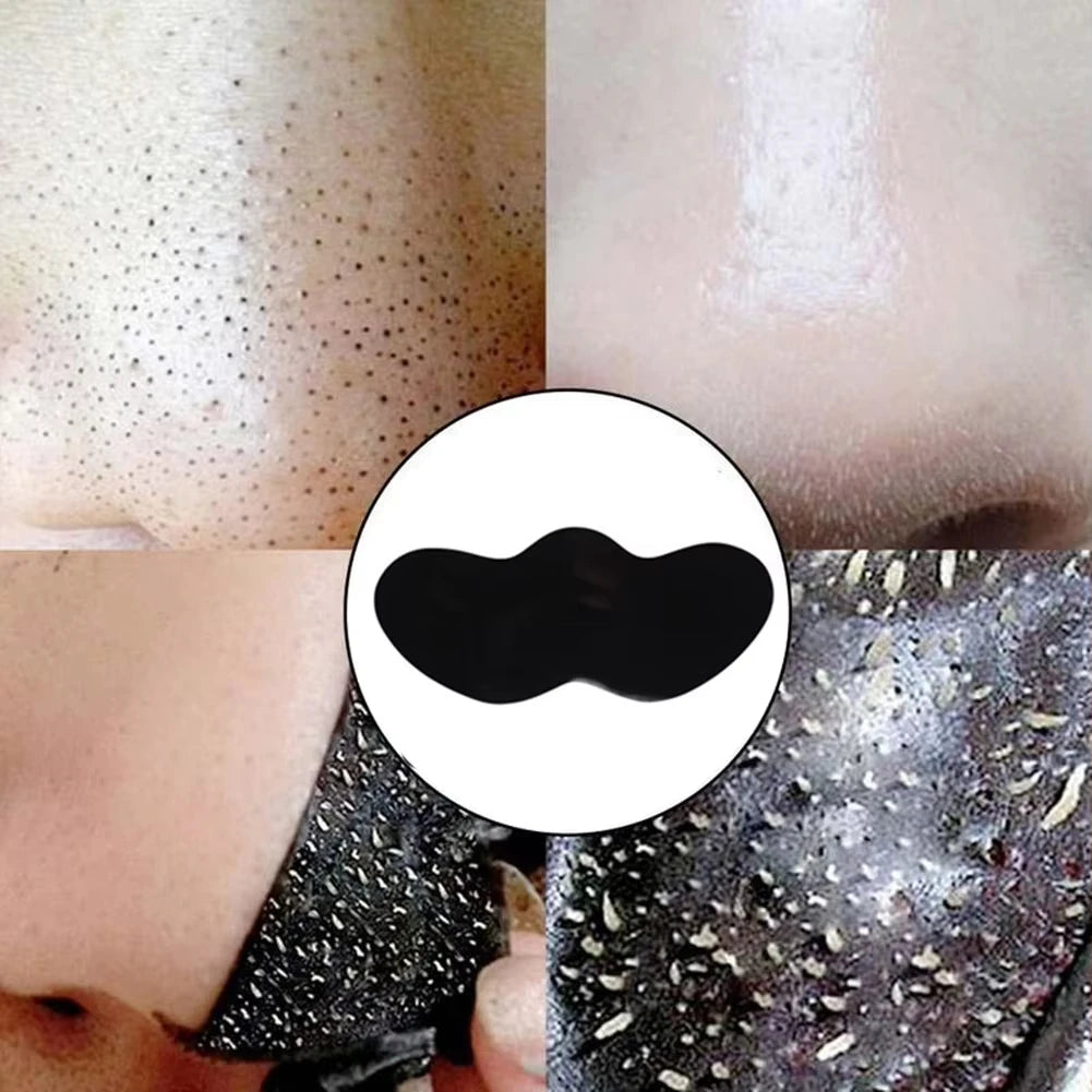 Lot de 10/50/100 autocollants pour éliminer les points noirs du visage - Autocollants efficaces pour nettoyer les pores et le nez, bâtonnets de soin doux et nettoyants en profondeur