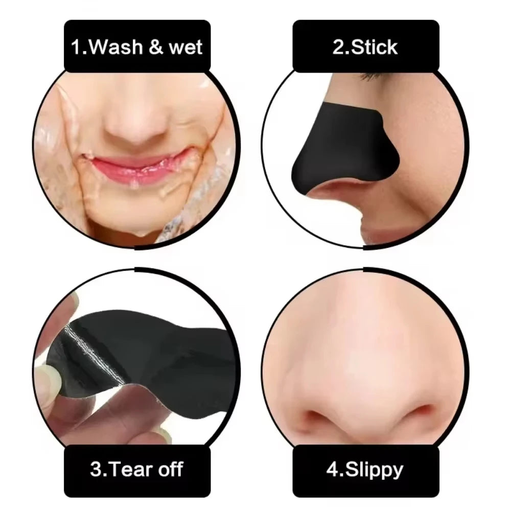 Lot de 10/50/100 autocollants pour éliminer les points noirs du visage - Autocollants efficaces pour nettoyer les pores et le nez, bâtonnets de soin doux et nettoyants en profondeur